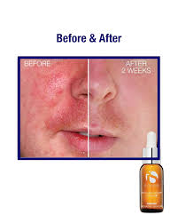 iS Clinical Super Serum Advanced+