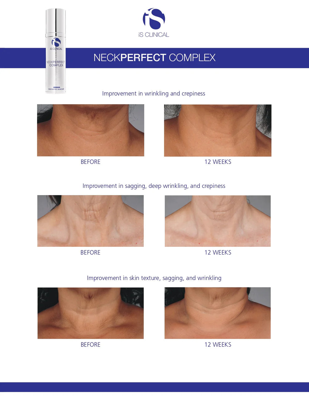 iS Clinical Neck Perfect Complex
