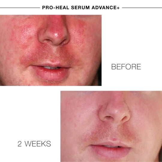iS Clinical Pro-Heal Serum Advance+