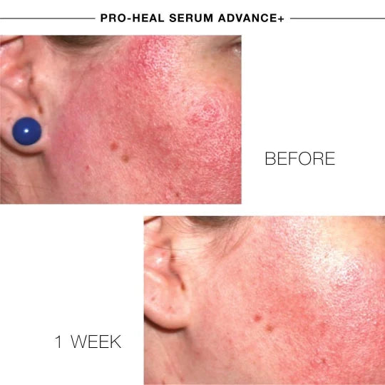 iS Clinical Pro-Heal Serum Advance+